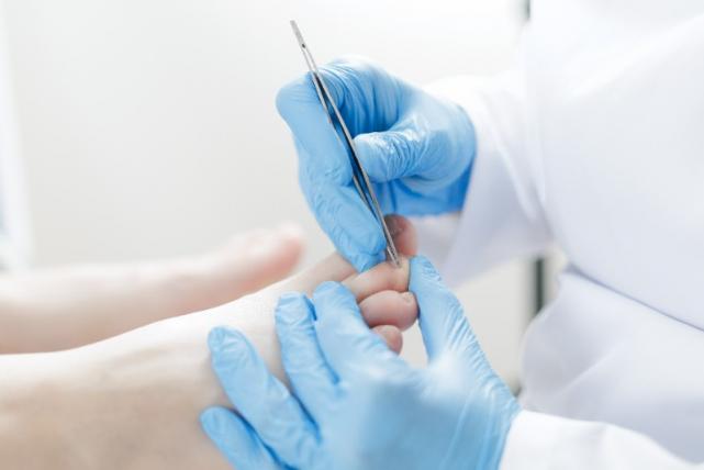 traitement ongle incarné Ransart