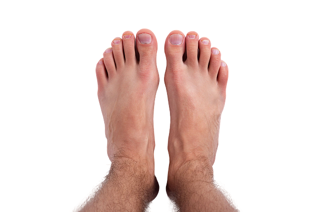 soigner un ongle incarné